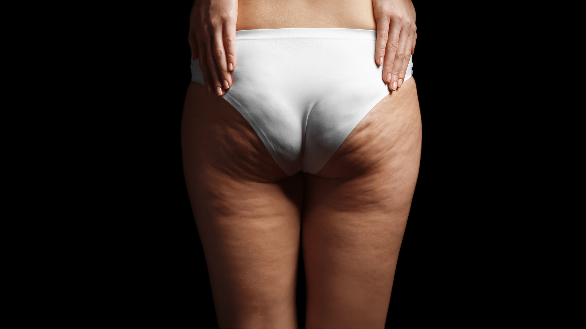 Pernas com lipedema